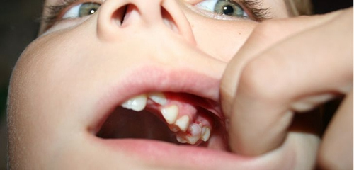 ӡŮͯĪʹҽȡ202ݣͼ